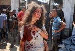 Mulher fica ferida após ataque aéreo israelense a café Al-Baqa, na Cidade de Gaza. 30/06/2025