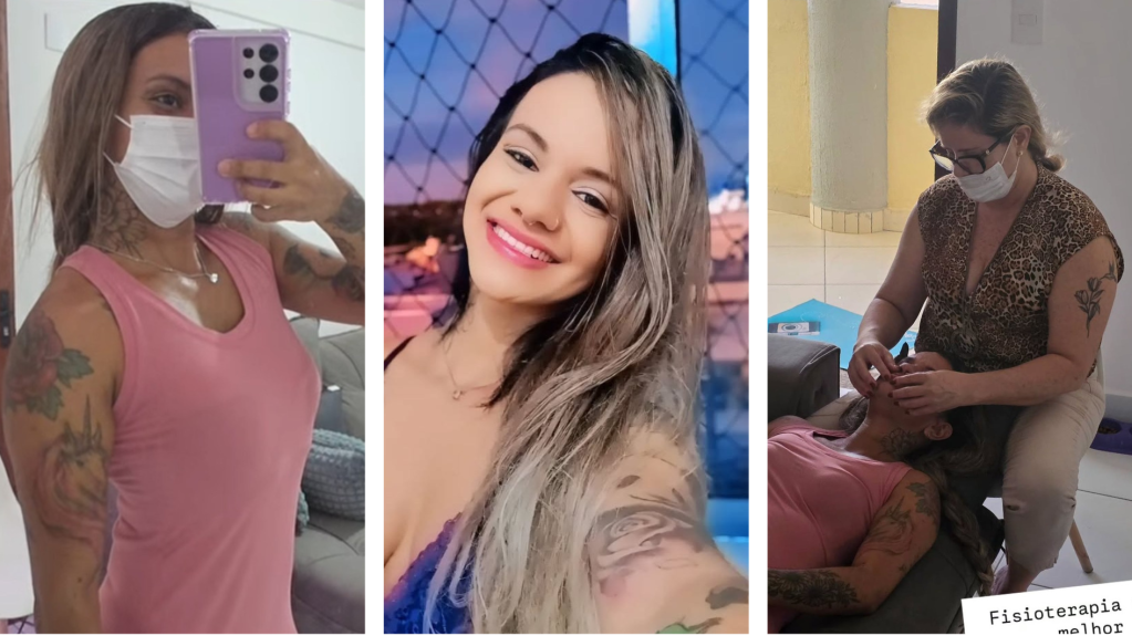Juliana Santos é acompanhada por vários profissionais no processo de recuperação após uma cirurgia de reconstrução facial pela qual passou após ser espancada com 61 socos do namorado