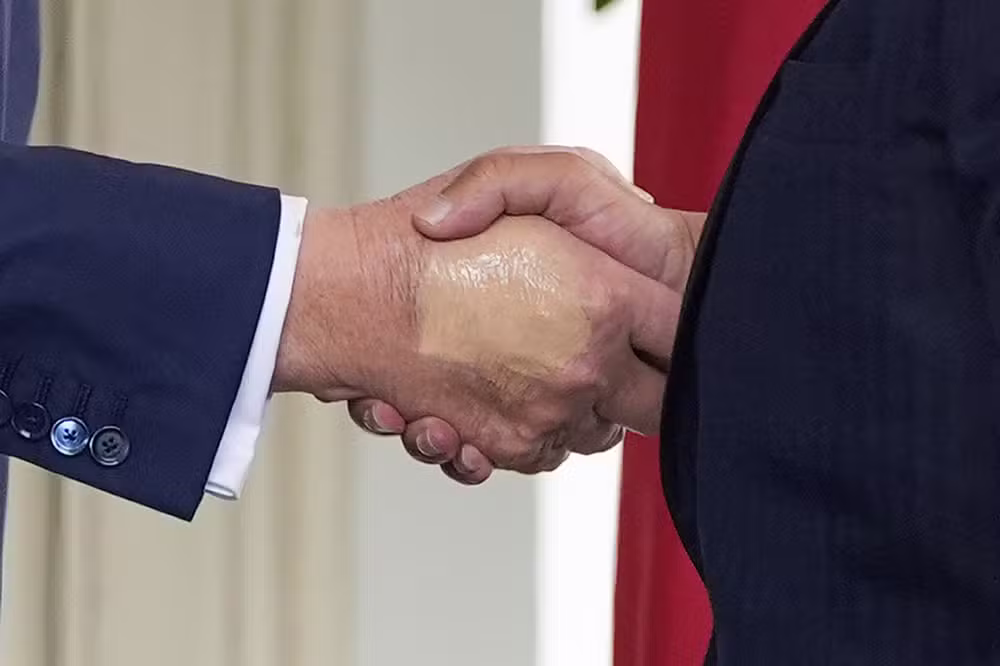 Por que Donald Trump está usando maquiagem na mão