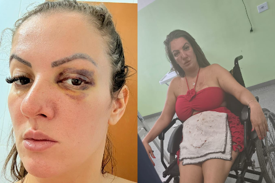 Vereadora atropela namorado na Grande SP após ser agredida e abandonada por ele na estrada