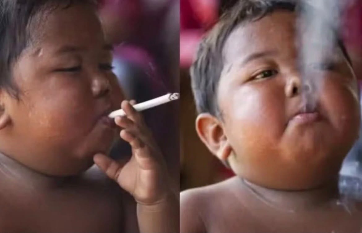 16 anos depois, como está menino que chocou o mundo por fumar 40 cigarros por dia