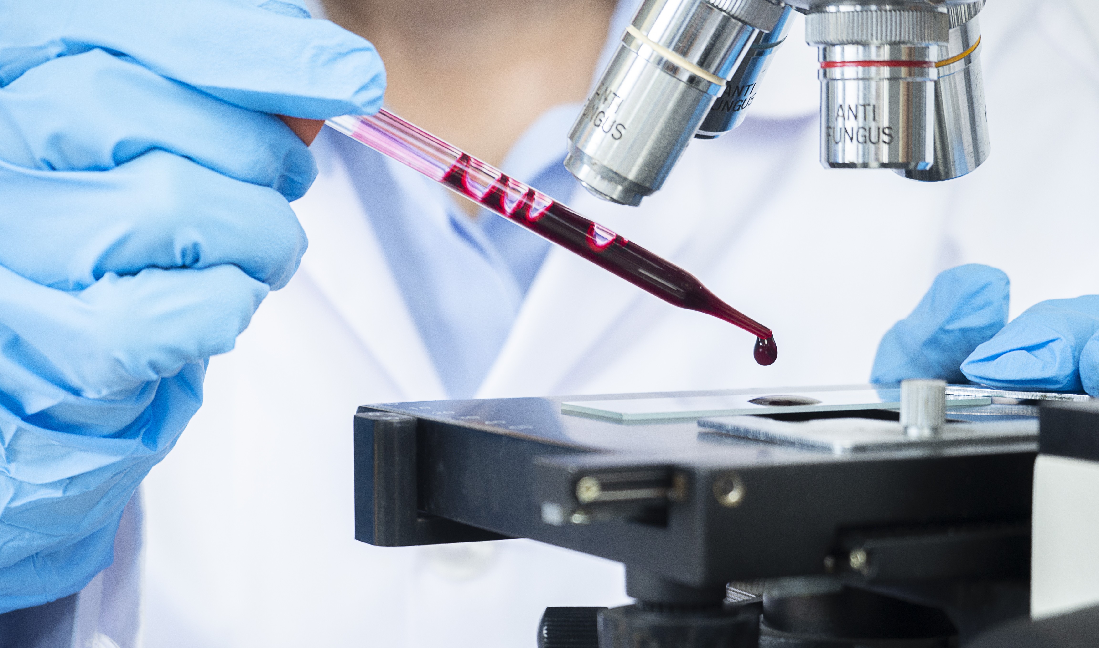 Teste de sangue que detecta sinal associado a mais de 50 tipos de câncer chega ao Brasil